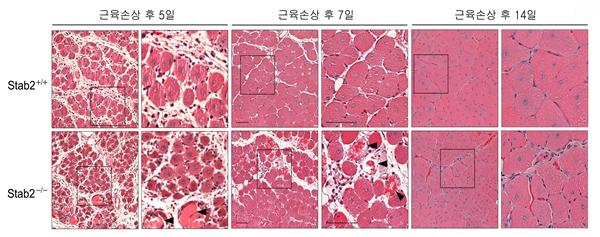 스태빌린-2 유전자결핍 생쥐에서 근육 손상 후 재형성의 결함