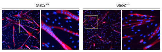 스태빌린-2 유전자결핍에 의해 근육세포 분화과정 동안에 세포 융합의 감소, 정상 생쥐의 근육세포 분화(좌), 스태빌린-2 유전자결핍 생쥐의 근육세포 분화(우)
