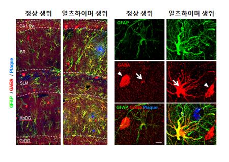 알츠하이머 병, 기억장애 치료를 위한 신약개발 가능성 열려