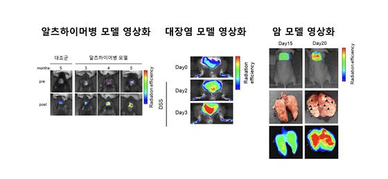 관절염, 통풍, 치매 등 염증성 질환 실시간 영상으로 관찰하여 조기 진단한다