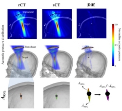 MRI 기반으로 CT 영상 생성하는 인공지능 기술 개발